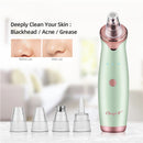 Blackhead Suction Beauty Machine Electric blackhead removal pore cleaner Acne exhaler