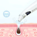 Electric Visual Blackhead Suction Instrument Household Cleansing Pore Cleaner Skin Care Tool